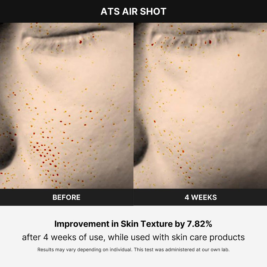 Age-R ATS Air Shot - Microneedling Pore Tightening Skin Care Device for Enhanced Absorption, Pore Refinement, and Smoother Skin Texture - Exfoliation, Skin Rejuvenation - Korean Skin Care